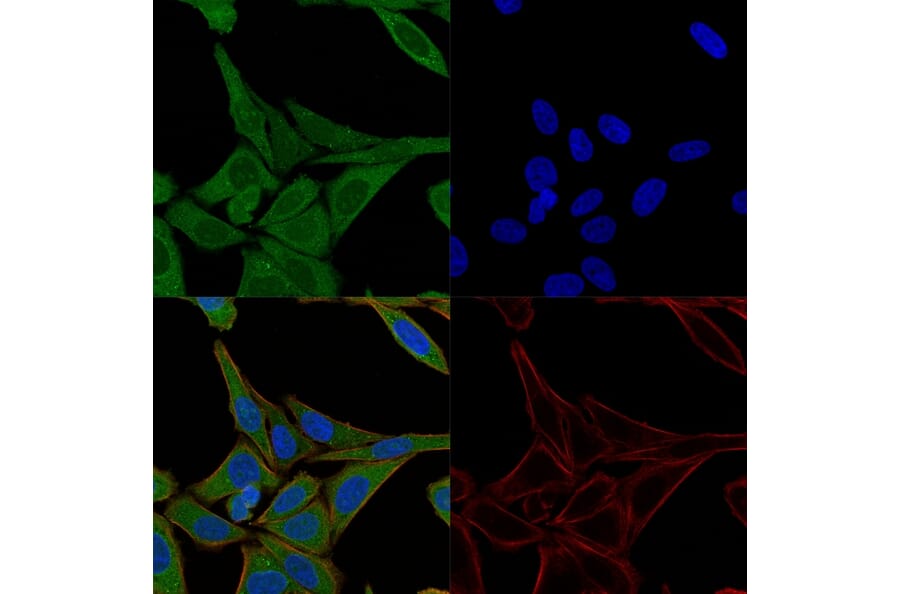 Immunofluorescence - Anti-Fascin Antibody [FSCN1/417] (A249991) - Antibodies.com