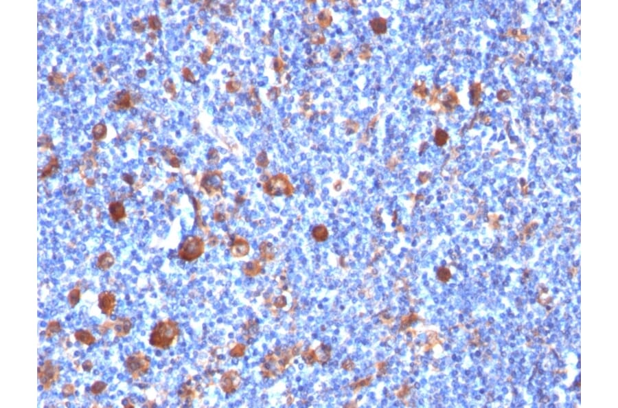 Immunohistochemistry - Anti-Fascin Antibody [SPM133] (A249992) - Antibodies.com