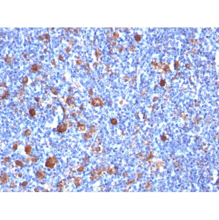 Immunohistochemistry - Anti-Fascin Antibody [SPM133] (A249992) - Antibodies.com