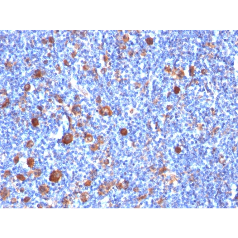 Immunohistochemistry - Anti-Fascin Antibody [SPM133] (A249992) - Antibodies.com