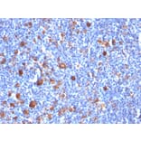 Immunohistochemistry - Anti-Fascin Antibody [SPM133] (A249992) - Antibodies.com