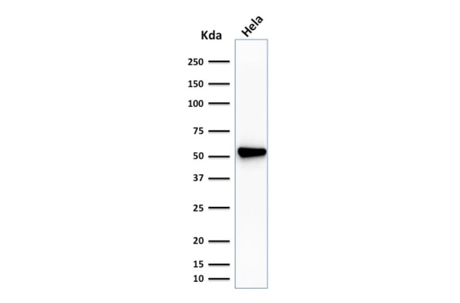 Western Blot - Anti-Fascin Antibody [SPM133] (A249992) - Antibodies.com