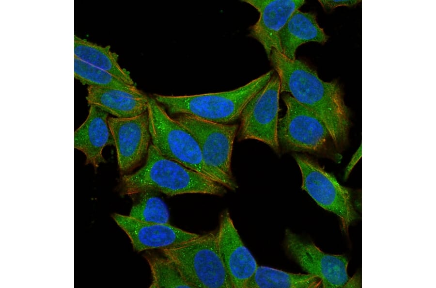 Immunofluorescence - Anti-Fascin Antibody [SPM133] (A249992) - Antibodies.com
