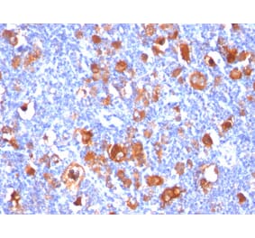 Immunohistochemistry - Anti-Fascin Antibody [FSCN1/418] (A249993) - Antibodies.com