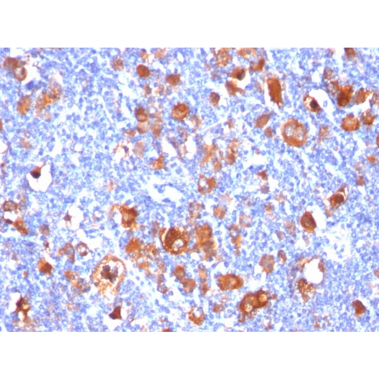 Immunohistochemistry - Anti-Fascin Antibody [FSCN1/418] (A249993) - Antibodies.com