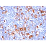 Immunohistochemistry - Anti-Fascin Antibody [FSCN1/418] (A249993) - Antibodies.com