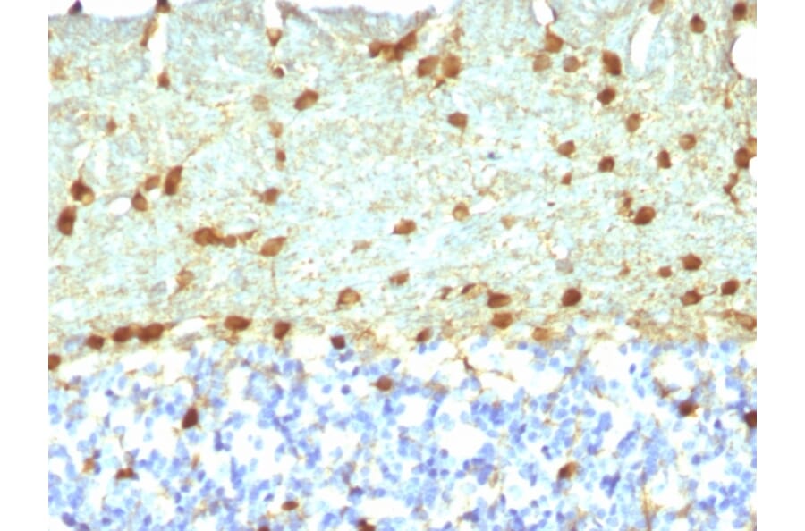 Immunohistochemistry - Anti-Fascin Antibody [FSCN1/418] (A249993) - Antibodies.com