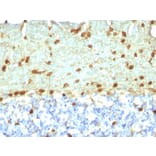 Immunohistochemistry - Anti-Fascin Antibody [FSCN1/418] (A249993) - Antibodies.com