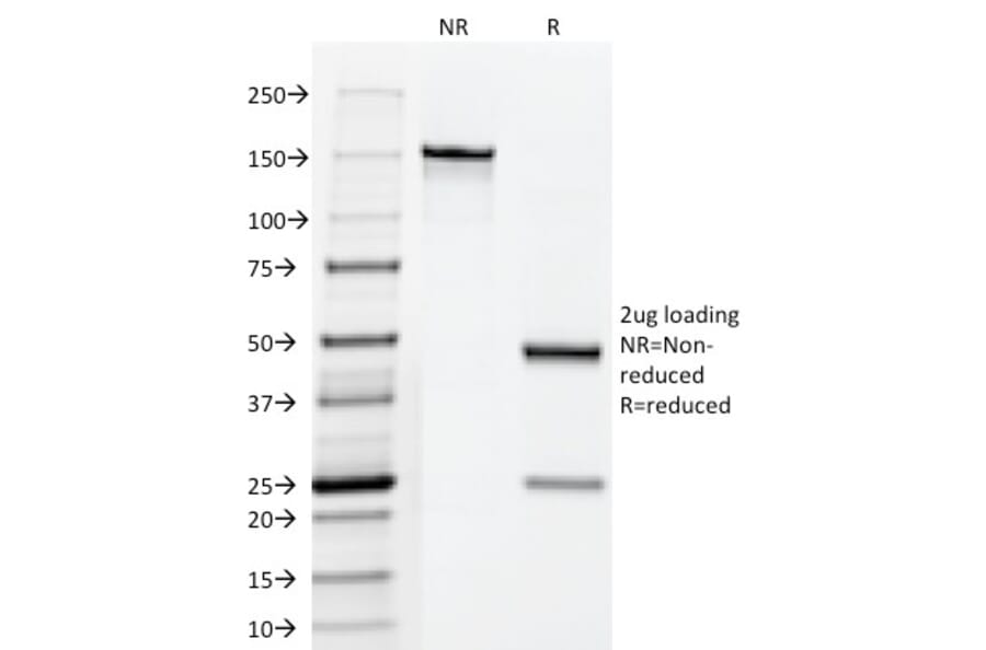 SDS-PAGE - Anti-Fascin Antibody [FSCN1/418] (A249993) - Antibodies.com