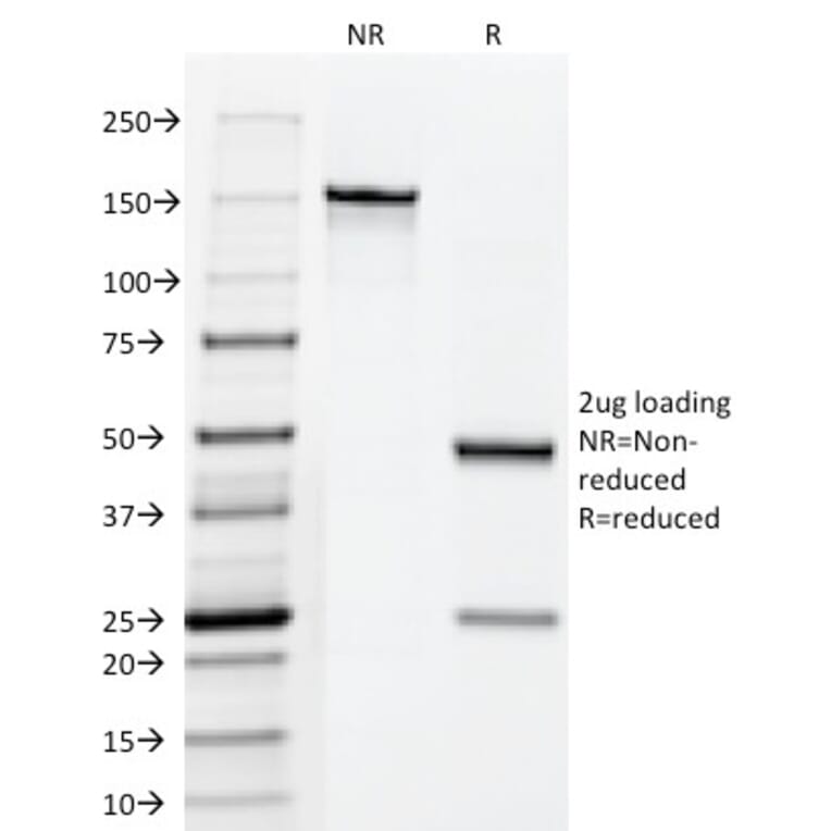 SDS-PAGE - Anti-Fascin Antibody [FSCN1/418] (A249993) - Antibodies.com