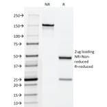 SDS-PAGE - Anti-Fascin Antibody [FSCN1/418] (A249993) - Antibodies.com