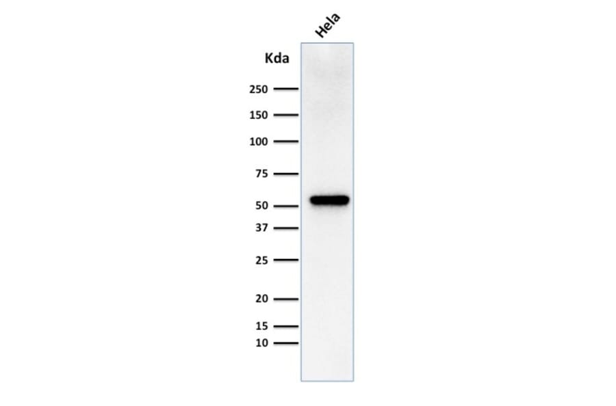 Western Blot - Anti-Fascin Antibody [FSCN1/418] (A249993) - Antibodies.com