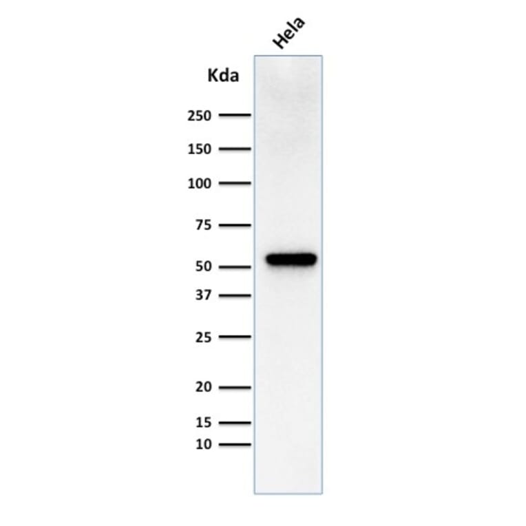 Western Blot - Anti-Fascin Antibody [FSCN1/418] (A249993) - Antibodies.com