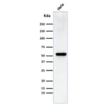 Western Blot - Anti-Fascin Antibody [FSCN1/418] (A249993) - Antibodies.com