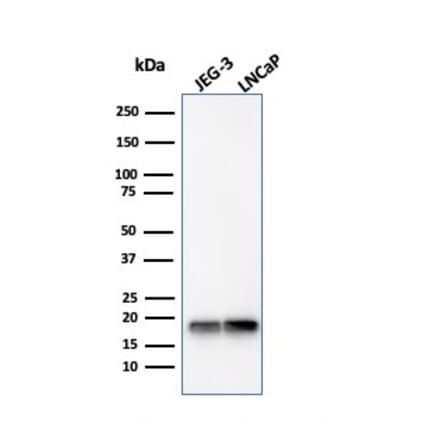 Western Blot - Anti-Superoxide Dismutase 1 Antibody [SOD1/4330] (A249994) - Antibodies.com