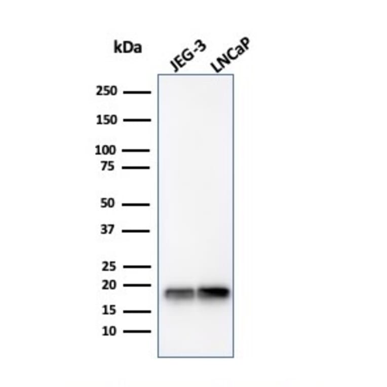 Western Blot - Anti-Superoxide Dismutase 1 Antibody [SOD1/4330] (A249994) - Antibodies.com