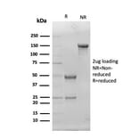 SDS-PAGE - Anti-Superoxide Dismutase 1 Antibody [SOD1/4330] (A249994) - Antibodies.com