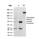 SDS-PAGE - Anti-Superoxide Dismutase 1 Antibody [SOD1/4331] (A249995) - Antibodies.com