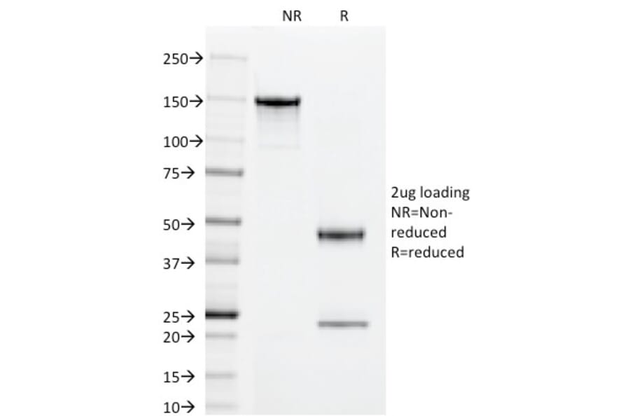 SDS-PAGE - Anti-Superoxide Dismutase 1 Antibody [SOD1/2089] (A249996) - Antibodies.com
