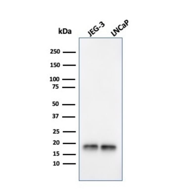 Western Blot - Anti-Superoxide Dismutase 1 Antibody [SOD1/3924] (A249997) - Antibodies.com