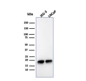 Western Blot - Anti-Superoxide Dismutase 1 Antibody [SOD1/3925] (A249998) - Antibodies.com