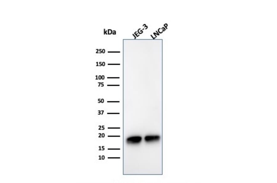 Western Blot - Anti-Superoxide Dismutase 1 Antibody [SOD1/3925] (A249998) - Antibodies.com