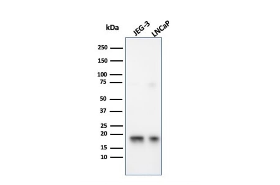 Western Blot - Anti-Superoxide Dismutase 1 Antibody [SOD1/3926] (A249999) - Antibodies.com