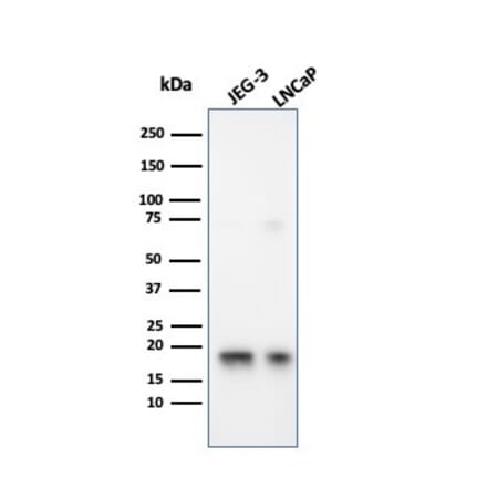 Western Blot - Anti-Superoxide Dismutase 1 Antibody [SOD1/3926] (A249999) - Antibodies.com