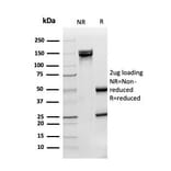 SDS-PAGE - Anti-Superoxide Dismutase 1 Antibody [SOD1/3926] (A249999) - Antibodies.com
