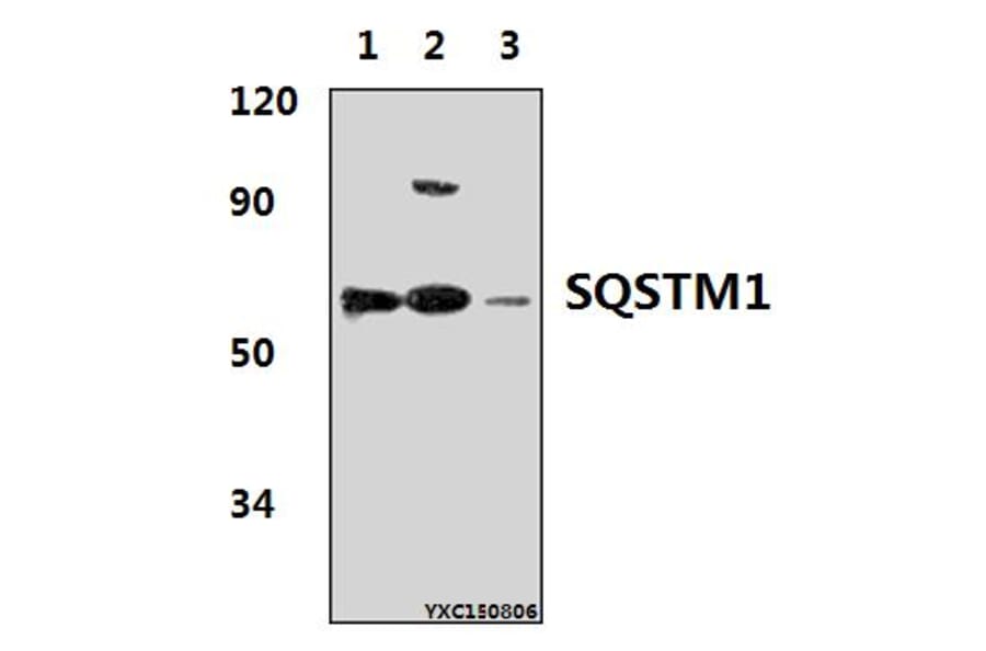 Anti-SQSTM1 Antibody from Bioworld Technology (AP6006) - Antibodies.com