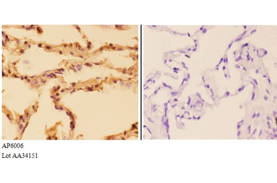 Anti-SQSTM1 Antibody from Bioworld Technology (AP6006) - Antibodies.com
