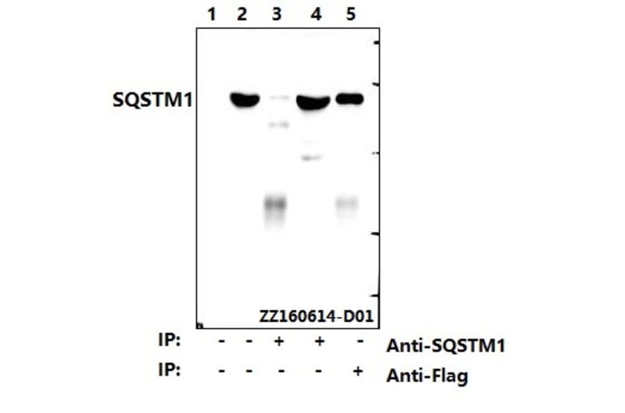 Anti-SQSTM1 Antibody from Bioworld Technology (AP6006) - Antibodies.com