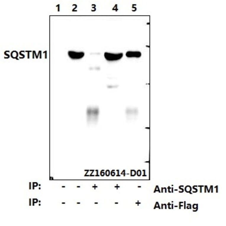 Anti-SQSTM1 Antibody from Bioworld Technology (AP6006) - Antibodies.com