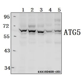 Anti-ATG5 Antibody from Bioworld Technology (AP6026) - Antibodies.com