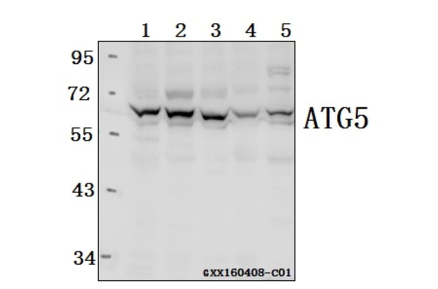 Anti-ATG5 Antibody from Bioworld Technology (AP6026) - Antibodies.com