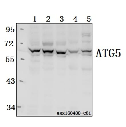 Anti-ATG5 Antibody from Bioworld Technology (AP6026) - Antibodies.com