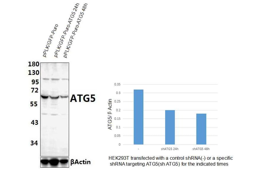 Anti-ATG5 Antibody from Bioworld Technology (AP6026) - Antibodies.com