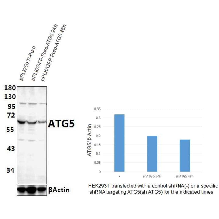 Anti-ATG5 Antibody from Bioworld Technology (AP6026) - Antibodies.com