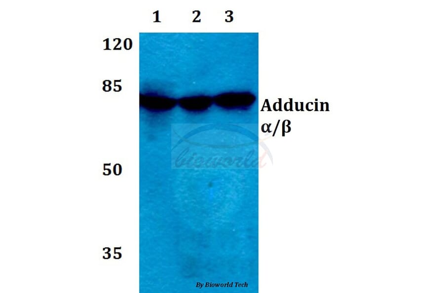 Anti-Adducin α/β (K720) Antibody from Bioworld Technology (BS1005) - Antibodies.com