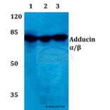 Anti-Adducin α/β (K720) Antibody from Bioworld Technology (BS1005) - Antibodies.com