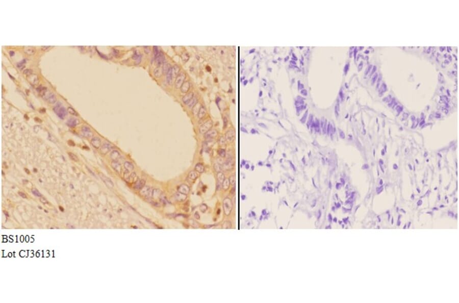 Anti-Adducin α/β (K720) Antibody from Bioworld Technology (BS1005) - Antibodies.com
