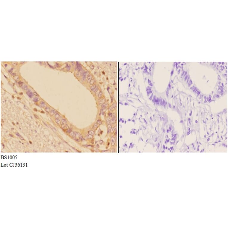 Anti-Adducin α/β (K720) Antibody from Bioworld Technology (BS1005) - Antibodies.com