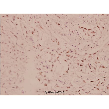 Anti-AKT (D302) Antibody from Bioworld Technology (BS1006) - Antibodies.com