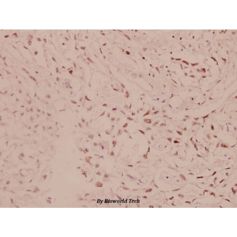Anti-AKT (D302) Antibody from Bioworld Technology (BS1006) - Antibodies.com
