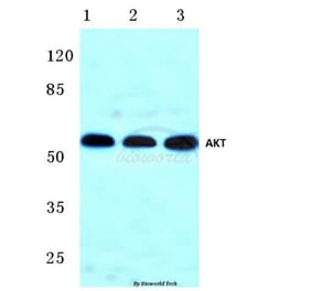 Anti-AKT (F469) Antibody from Bioworld Technology (BS1007) - Antibodies.com