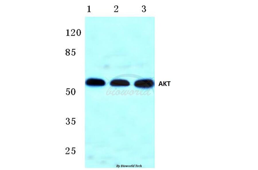 Anti-AKT (F469) Antibody from Bioworld Technology (BS1007) - Antibodies.com