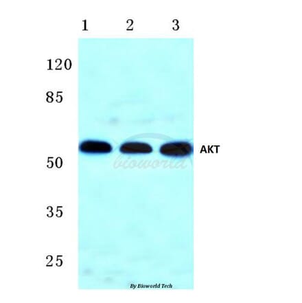 Anti-AKT (F469) Antibody from Bioworld Technology (BS1007) - Antibodies.com