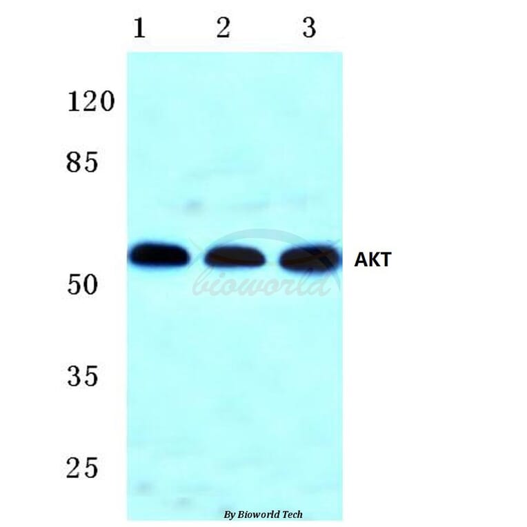 Anti-AKT (F469) Antibody from Bioworld Technology (BS1007) - Antibodies.com