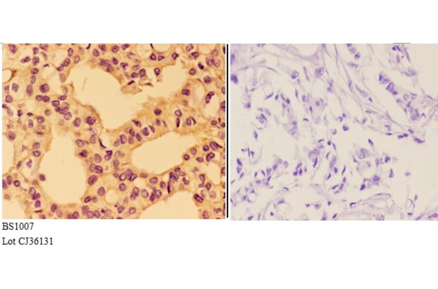 Anti-AKT (F469) Antibody from Bioworld Technology (BS1007) - Antibodies.com