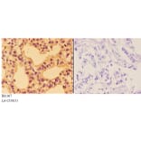 Anti-AKT (F469) Antibody from Bioworld Technology (BS1007) - Antibodies.com